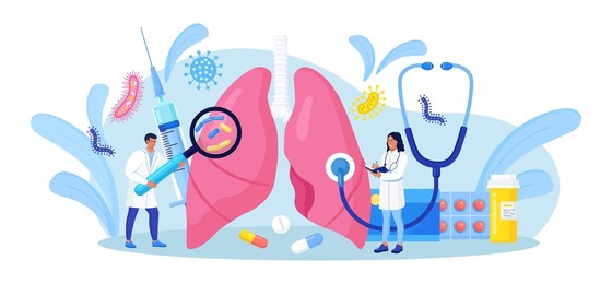 pulmonology. tiny doctors examining lungs. tuberculosis, pneumonia, lung cancer treatment or diagnostic. internal organ inspection for respiratory system illness, disease or problems. vector design
