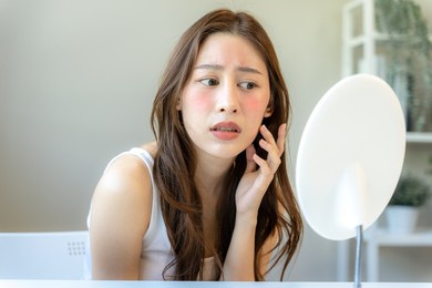 beautiful asian women are worried about faces allergic to chemicals in cosmetics. red face from sunburn, sensitive skin, allergic to steroids
