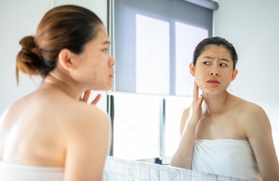 asian woman feeling stress after looking her face in mirror. she dissatisfied her face caused of acne and scar problem.