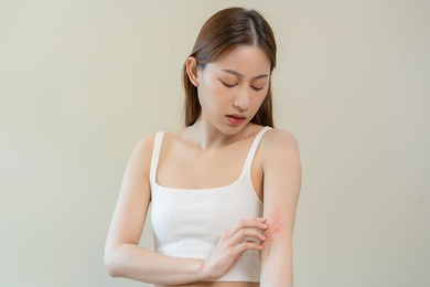 dermatology, asian young woman looking on her arm allergy, allergic reaction from atopic, insect bites, hand in scratching itchy, itch red spot or rash of skin. beauty problem by medical treatment.