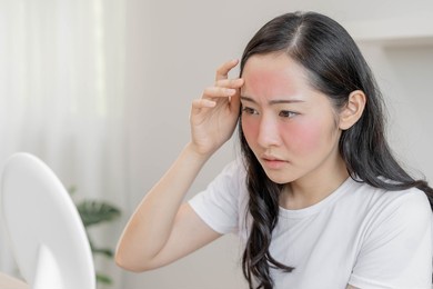dermatology, puberty asian young woman, girl looking into mirror, allergy presenting an allergic reaction from cosmetic, red spot or  rash on face. beauty care from skin problem by medical treatment.