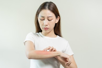 dermatology asian young woman, girl allergy, allergic reaction from atopic, insect bites on her arm, hand in scratching itchy, itch red spot or rash of skin. healthcare, treatment of beauty.
