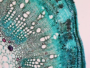 light photomicrograph of cotton stem cross section seen through microscope