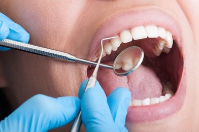 dentist cleaning perfect teeth of a beautiful mouth female
