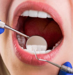 close-up of female open mouth during oral checkup at the dentist. doing professionally. smiling pretty woman is having her teeth examined by dentist in clinic. dental care, taking care of teeth.