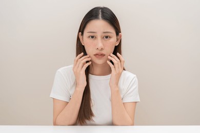 dermatology, expression face worry, stressed asian young woman hand touching face at dark spot of melasma, freckle from pigment melanin, allergy sun. beauty care, skin problem treatment, acne skincare