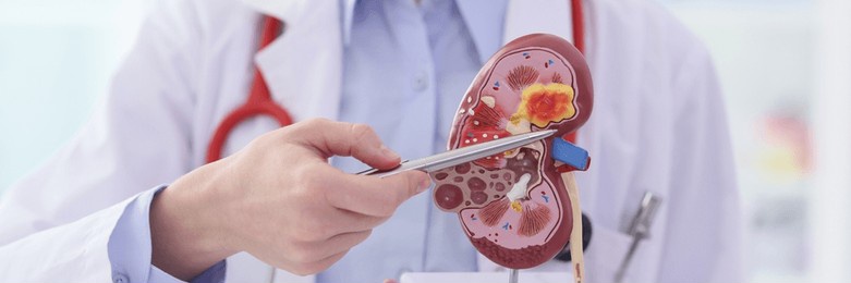 doctor in work uniform points pen to inflammation of kidney artificial model. specialist demonstrates structure and diseases of human in clinic office