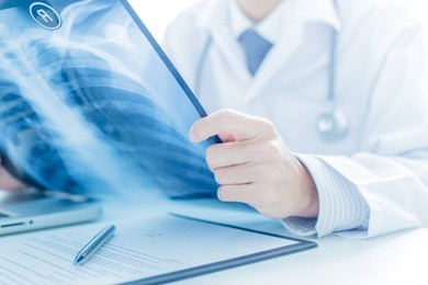 close up of male doctor holding x-ray or roentgen image