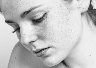 young beautiful freckles woman face portrait with healthy skin black and white