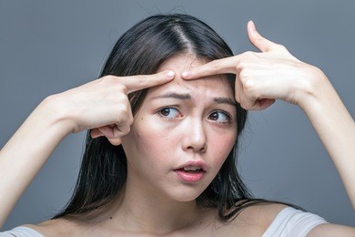 chinese woman squeezing a spot on her forehead