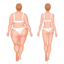 fat woman and slender woman in white underwear. back view. overweight and slenderness. healthy and unhealthy lifestyle