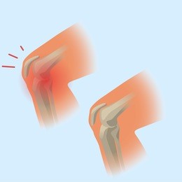knee joint