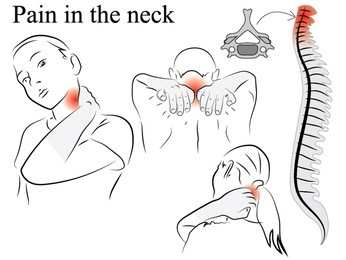pain in the neck. pencil drawing, black and white illustration. spine schematic image of women and men are held by the neck.