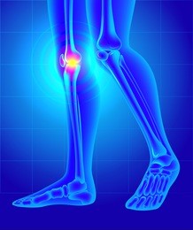 knee pain. x-ray of the skeleton and legs. vector illustration created with gradient mesh.