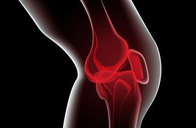 zoom painful knee x-ray