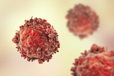 leukaemia white blood cells, 3d illustration. cancer cells