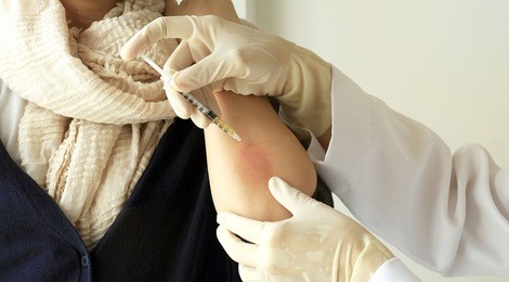 doctor injecting at patient's arm, dermatologist doctor doing treatment, female patient with allergic rash dermatitis eczema skin, skin diseases.