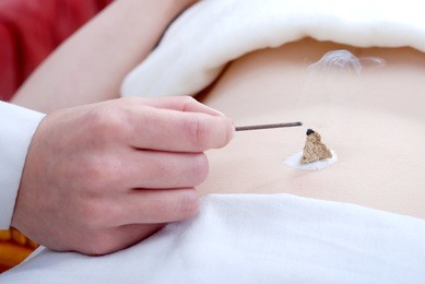 acupuncture - application of needles