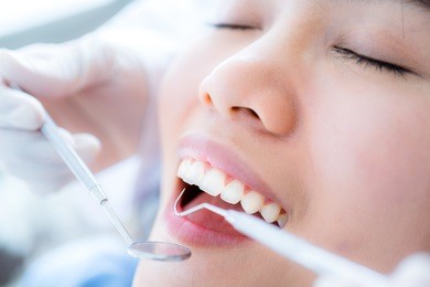 close-up of young female having her teeth examinated