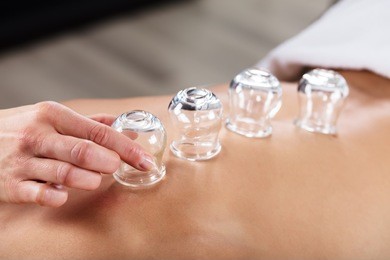 therapist placing transparent glass cups on person's back in spa