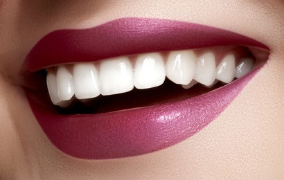 beautiful smile with whitening teeth. dental photo. macro closeup of perfect female mouth, lipscare rutine.