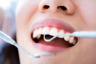 close-up of young female having her teeth examinated