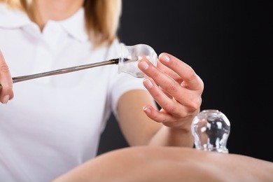 female therapist giving cupping treatment on back at spa