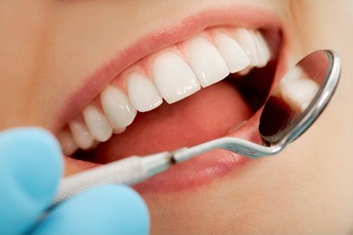 close-up of patient?s open mouth during oral checkup with mirror near by