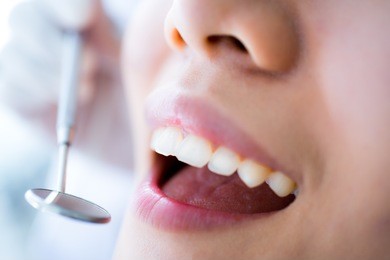 close-up of young female having her teeth examinated