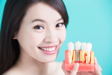 woman take tooth implant false tooth on green background
