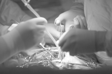 the hands of the surgeon and assistants at the time of surgery