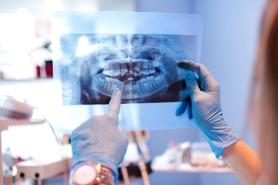 close-up of female doctor pointing at teeth x-ray image at dental office.