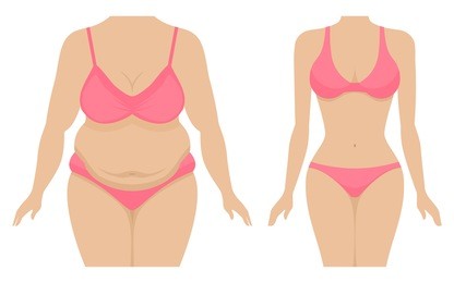 vector illustration of a fat and thin female body. isolated white background. the body of a woman before and after losing weight. flat style. belly and breasts of a girl after losing weight.