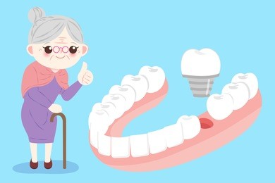 old woman with implants tooth on the blue bakcground