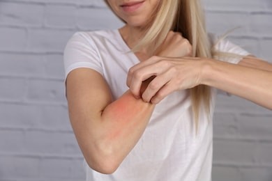 woman scratching an itch on white background . sensitive skin, food allergy symptoms, irritation