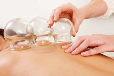 detail of an acupuncture therapist removing a glass globe in a fire cupping procedure