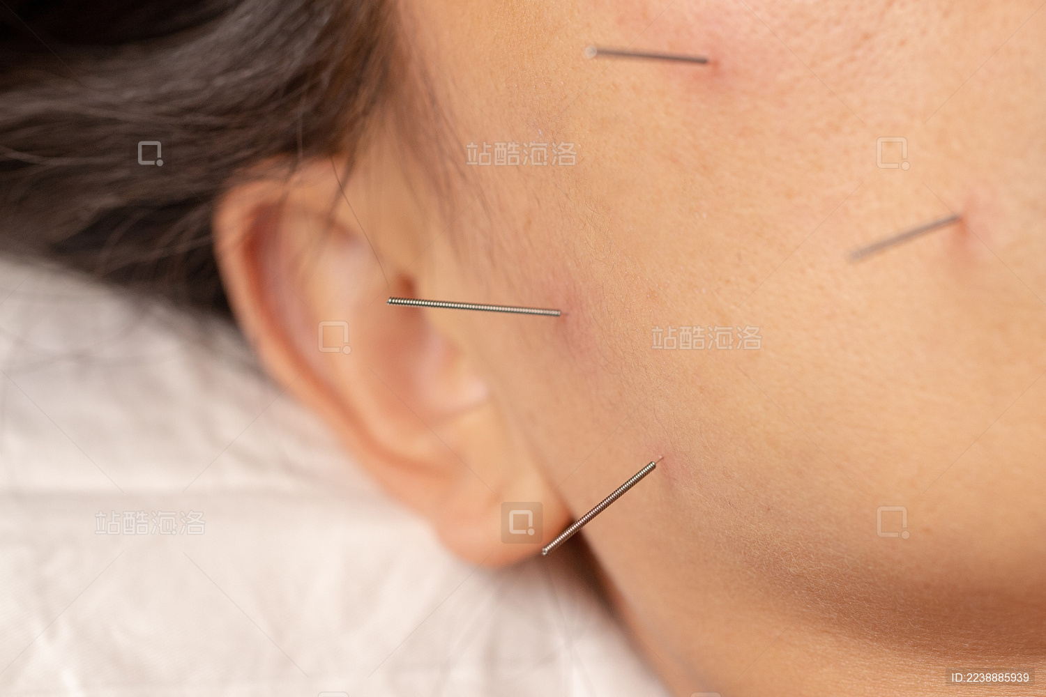 女人面部针灸中医治疗理疗调养调理图片下载 - 觅知网