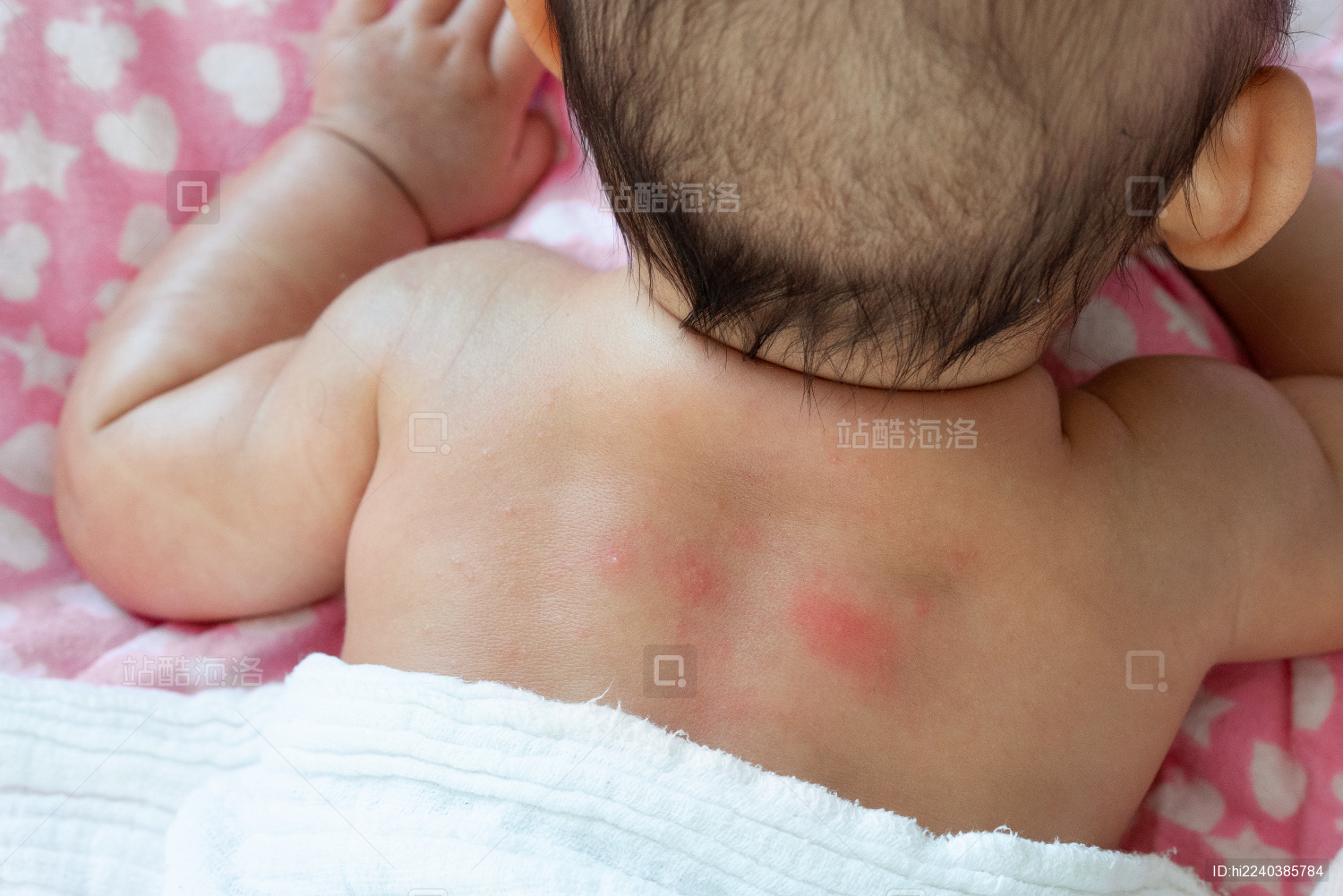 婴儿脸上起红疹子怎么办（不管宝宝长哪种疹子）-幼儿百科-魔术铺