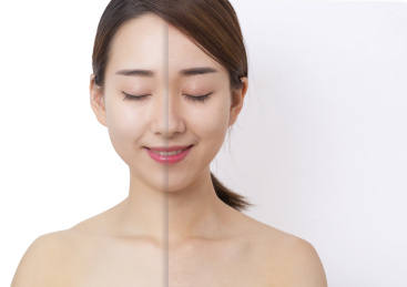 年轻的女性和改变的皮肤，光滑的皮肤和粗糙的皮肤对比，前后改变