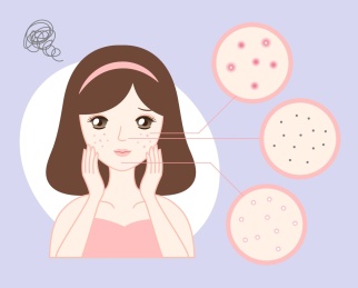 可爱少女祛痘粉刺护肤美容插画