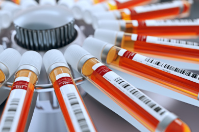 血样试管在离心机中被分析，高科技化验，采样分析的概念。