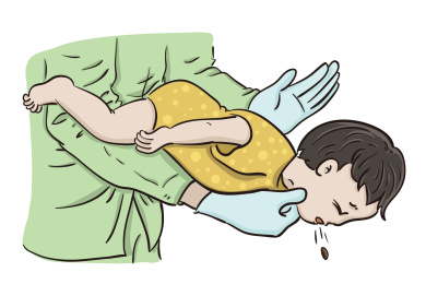 海姆立克急救法-幼儿方法2