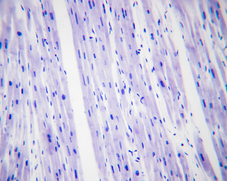成纤维细胞简图图片