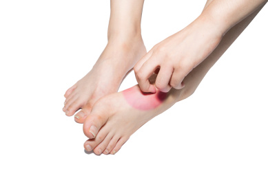 一个人脚部红肿痒痒正在挠痒痒疑似得了脚气香港脚灰指甲棚拍白色背景