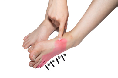 一个人脚部红肿痒痒正在挠痒痒疑似得了脚气香港脚灰指甲棚拍白色背景