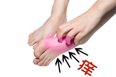 一个人脚部红肿痒痒正在挠痒痒疑似得了脚气香港脚灰指甲棚拍白色背景