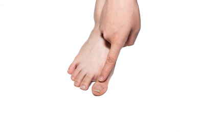 一个人脚部瘙痒难耐疑似得了灰指甲脚气香港脚正在挠痒痒解痒棚拍白色背景