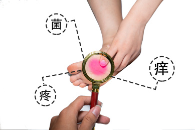 专家用放大镜诊断脚部臭味瘙痒细菌病菌感染疾病灰指甲脚气香港脚棚拍白色背景