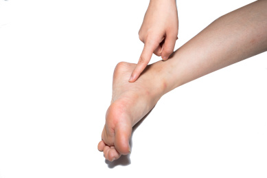 一个人脚部瘙痒难耐疑似得了灰指甲脚气香港脚正在挠痒痒解痒棚拍白色背景