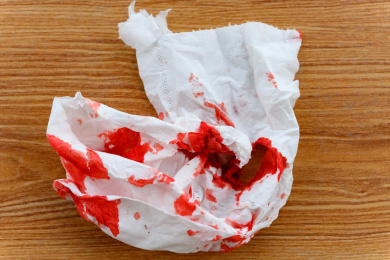 纸巾都是血的真实照片图片
